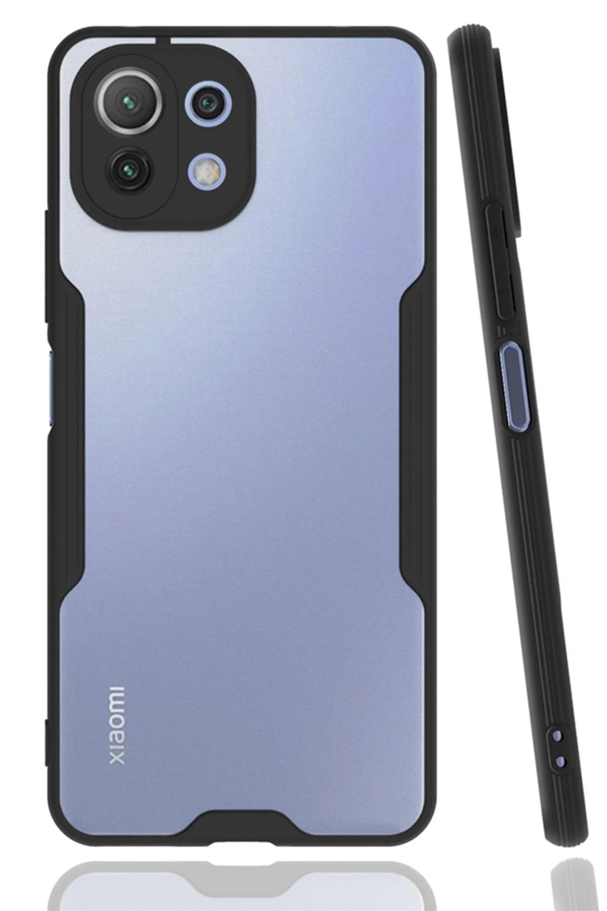 Xiaomi Mİ 11 Lite Kılıf Platin Silikon - Siyah-(5796)