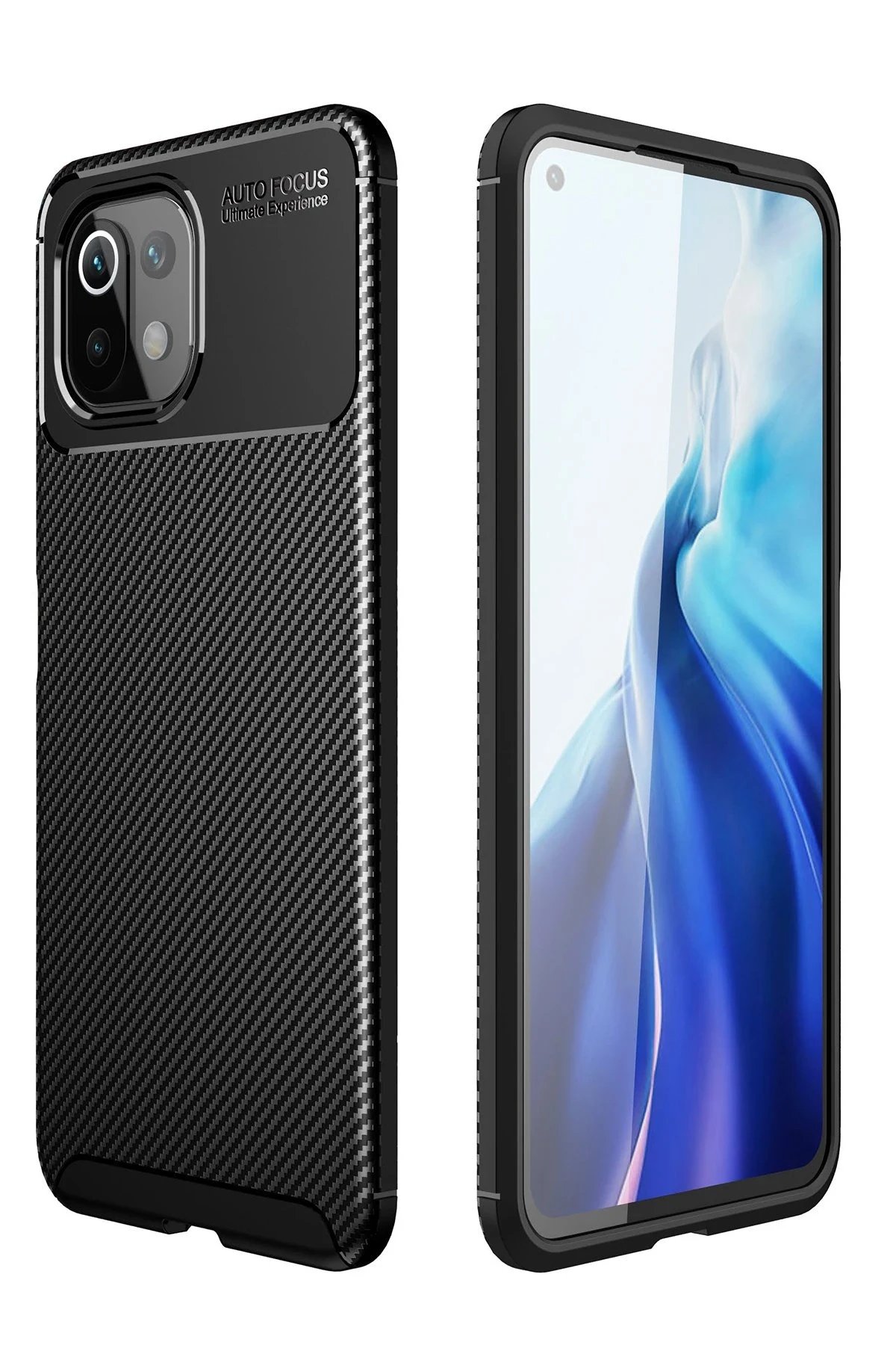 Xiaomi Mİ 11 Lite Kılıf Auto Focus Karbon Kapak - Siyah-(5796)