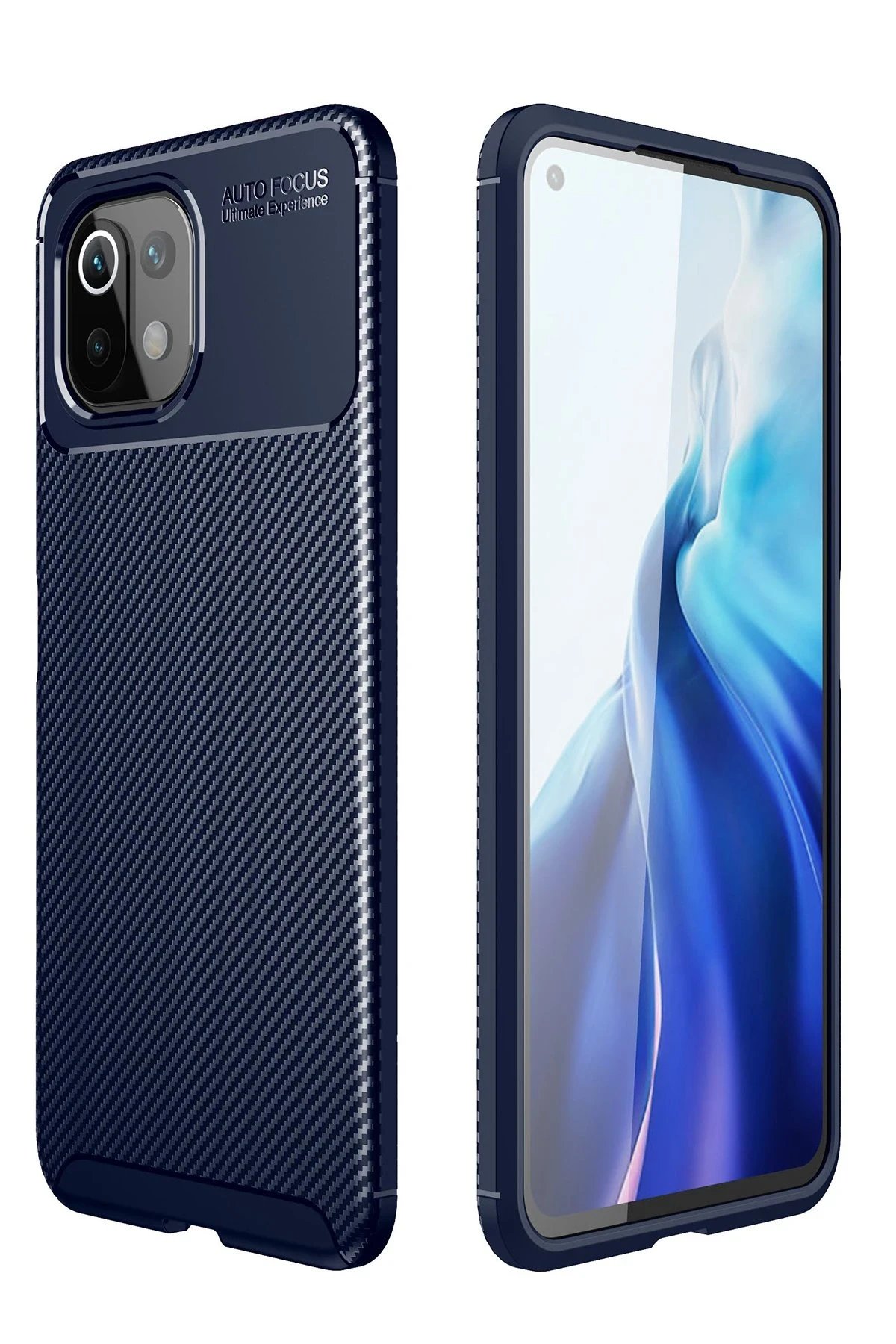 Xiaomi Mİ 11 Lite Kılıf Auto Focus Karbon Kapak - Lacivert-(5796)