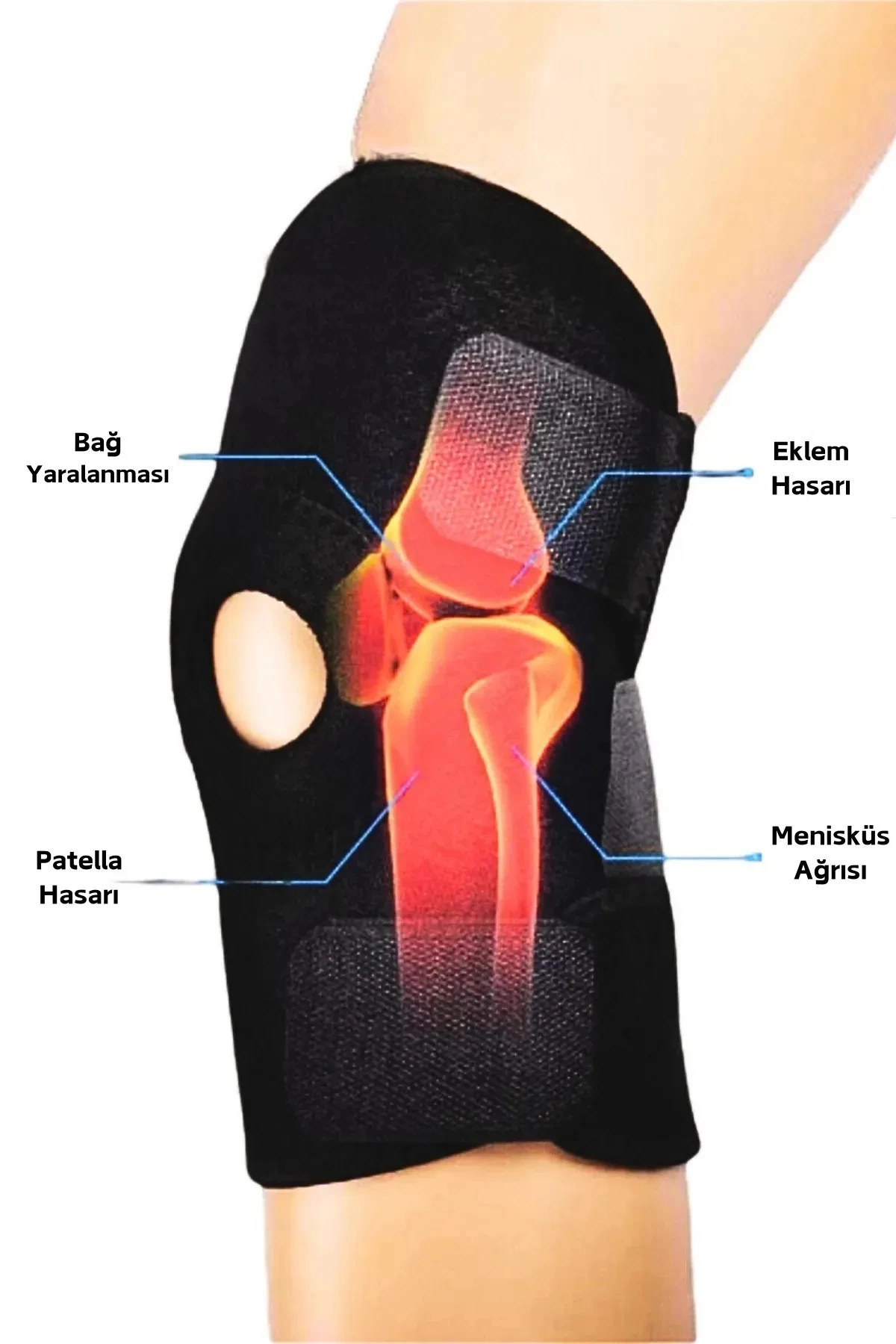Medical Patella Destekli Diz Korsesi Capraz Bag Meniskus Agrisi Icin Sporcu Dizlik 365150641 Sw1200sh1800 3 700x1050 Topuk Çorabı 2'li Sağ Sol+ Medical Patella Destekli Dizlik + Termojel – Ortopedik Destek Seti najmaddin.com Topuk Çorabı 2'li Sağ Sol+ Medical Patella Destekli Dizlik + Termojel – Ortopedik Destek Seti - Görsel 3