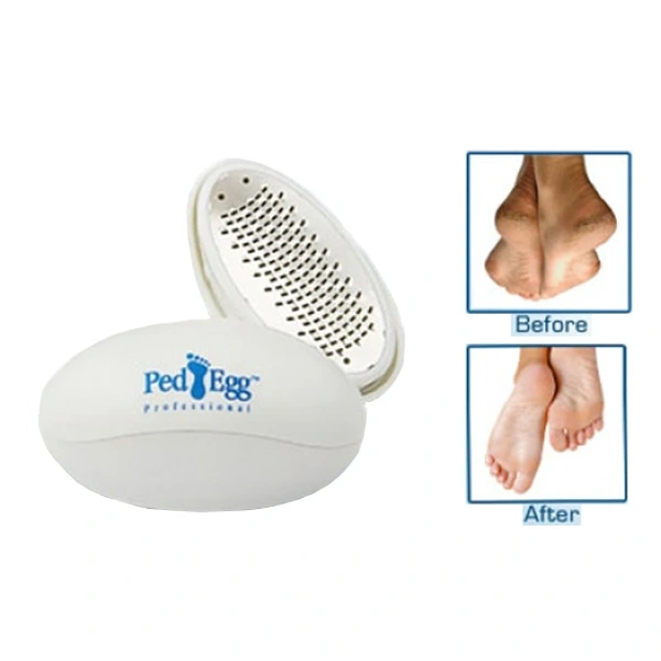 Ped Egg Topuk Torpusu 130571943 Sw600sh600 Ped Egg Topuk Törpüsü najmaddin.com Ped Egg Topuk Törpüsü