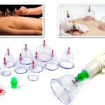 12 parça vakumlu hacamat kupa çekme seti