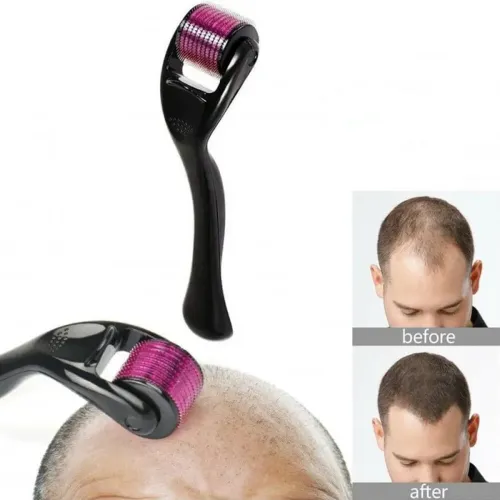 Derma Roller Titanyum Cilt Bakim Aleti 2 500x500 4 Titanyum Derma Roller Cilt Bakım Aleti 0.5 mm najmaddin.com canlı ve genç görünmesine yardımcı olur.Ürünün Temel Özellikleri ve Cilt Faydaları:Ev Tipi İdeal Ölçü: 0.5 mm iğne uzunluğu