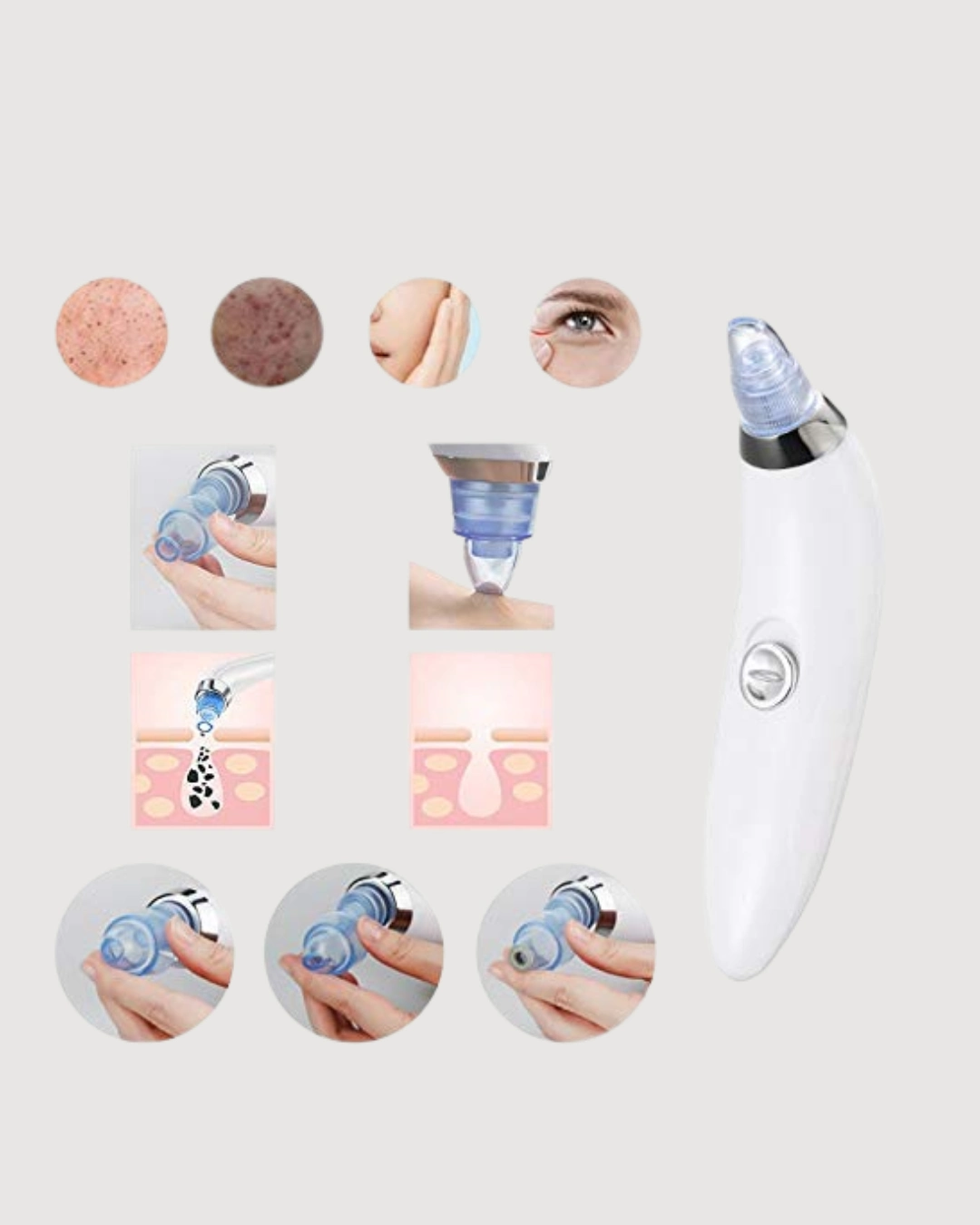 Vakum Teknolojili Siyah Nokta Temizleyici Cihaz 4 Farkli Baslik Ve Derinlemesine Goze75767371 Sw1080sh1350 700x875 Vakum Teknolojili Siyah Nokta Temizleyici Cihaz – 4 Farklı Başlık ve Derinlemesine Gözenek Temizliği najmaddin.com beyaz nokta